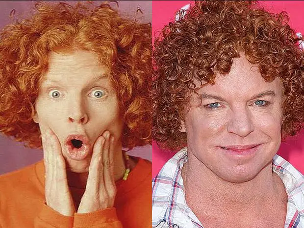 Carrot Top Denies Before And After Plastic Surgery Claims