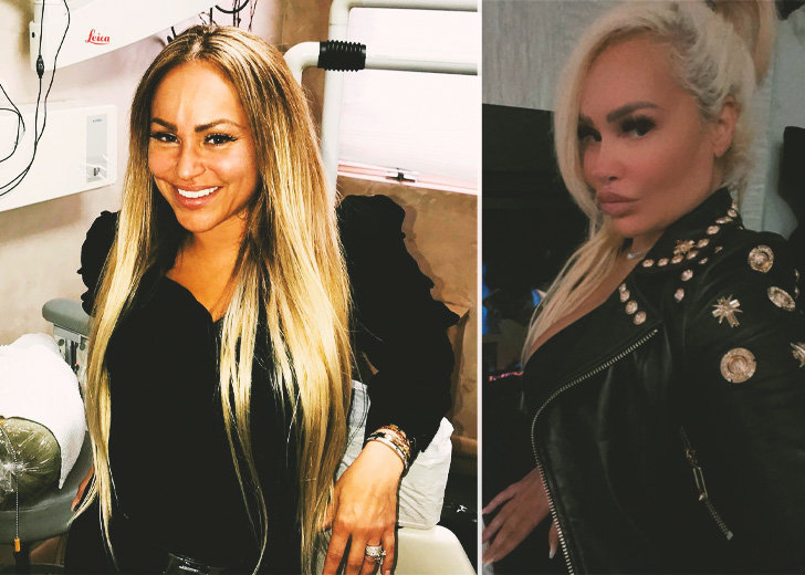 What Did Darcey Silva Look Like Before Plastic Surgery?