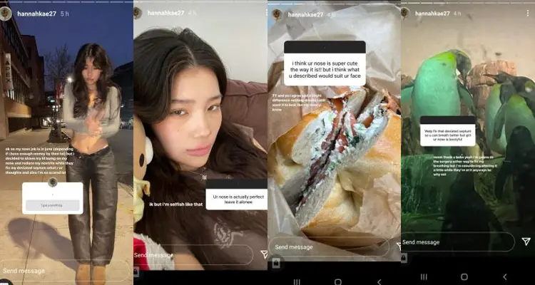 Hannah Kae's Instagram stories from December 2021 where she asked for opinions on a nose job.