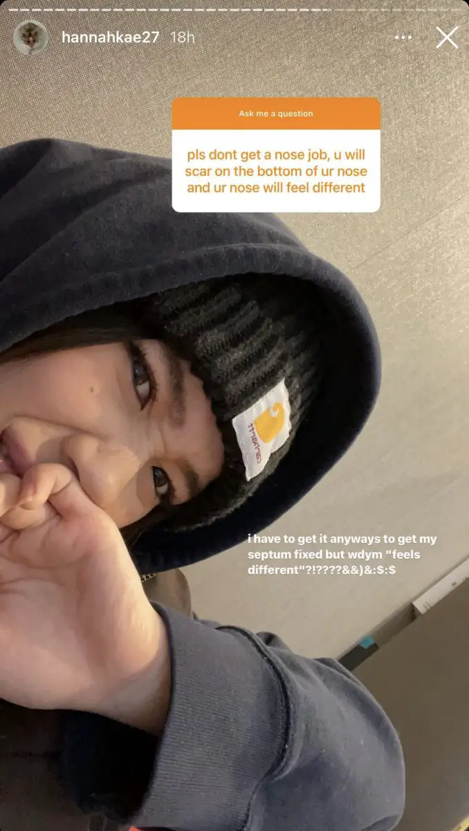 Hannah Kae Getting Nose Job Amidst Plastic Surgery Claims