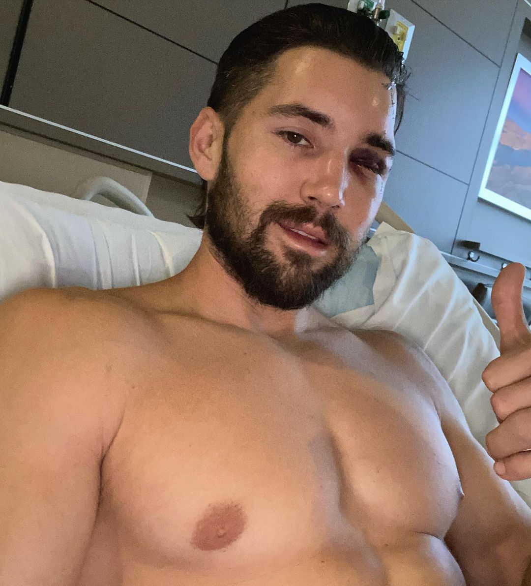 Jeff Wittek after his accident caused by David Dobrik