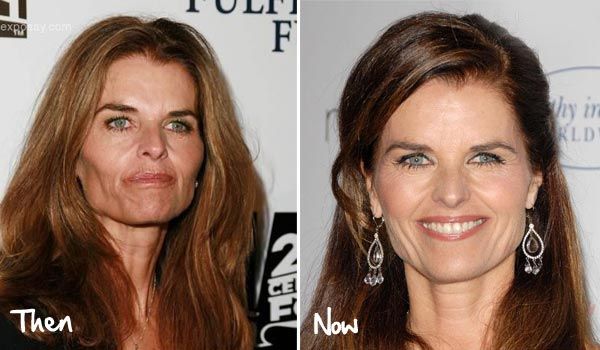 Maria Shriver