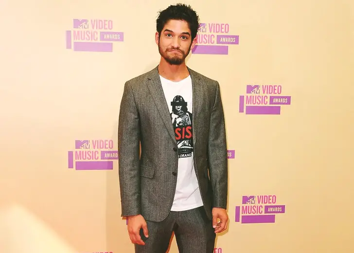 Tyler-Posey-Battle-with-Depression
