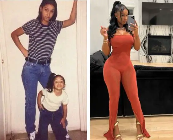 Bernice Burgos before and after plastic surgery.