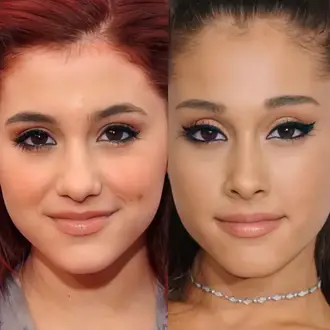 Ariana grande plastic surgery