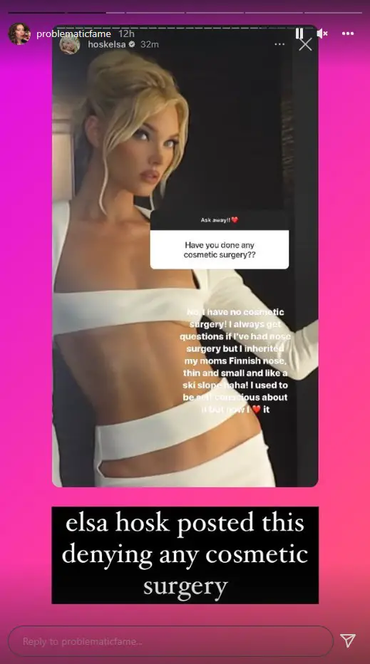 Elsa Hosk denies getting plastic surgery while answering fan questions on Instagram in April 2022.