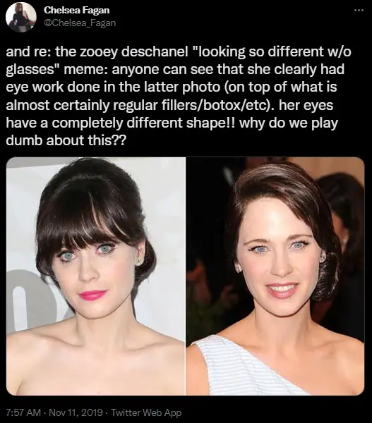 Zooey Deschanel alleged for having work done on her eye.