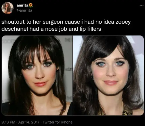 Zooey Deschanel alleged plastic surgery then and now comparison.